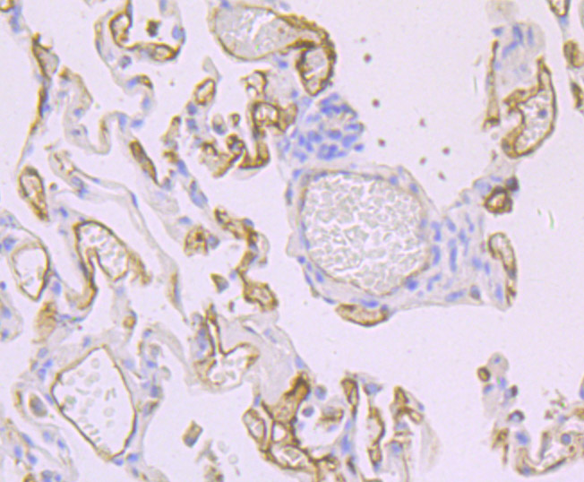 Thrombomodulin Rabbit mAb