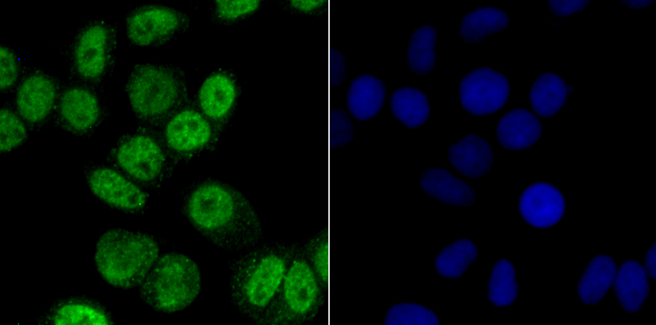 CAMKIV Rabbit mAb