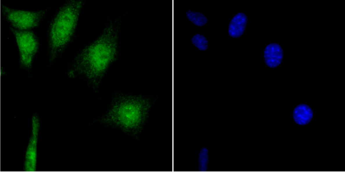 CAMKIV Rabbit mAb
