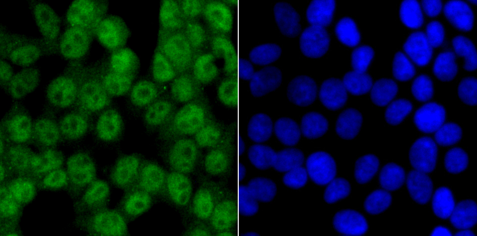 CAMKIV Rabbit mAb