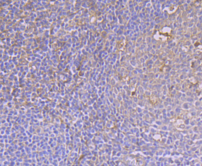 CAMKIV Rabbit mAb