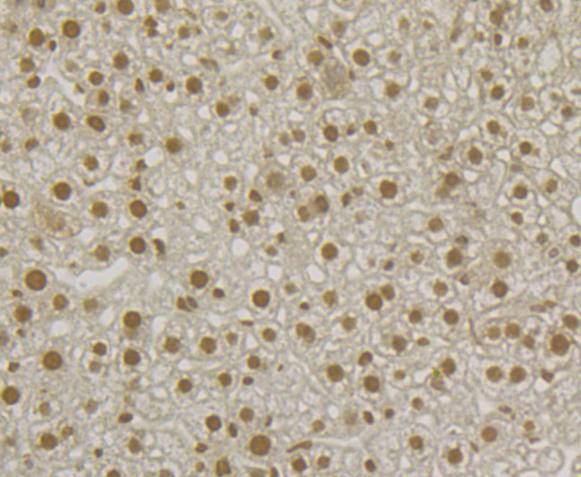 U1A Rabbit mAb