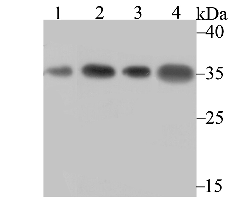 U1A Rabbit mAb