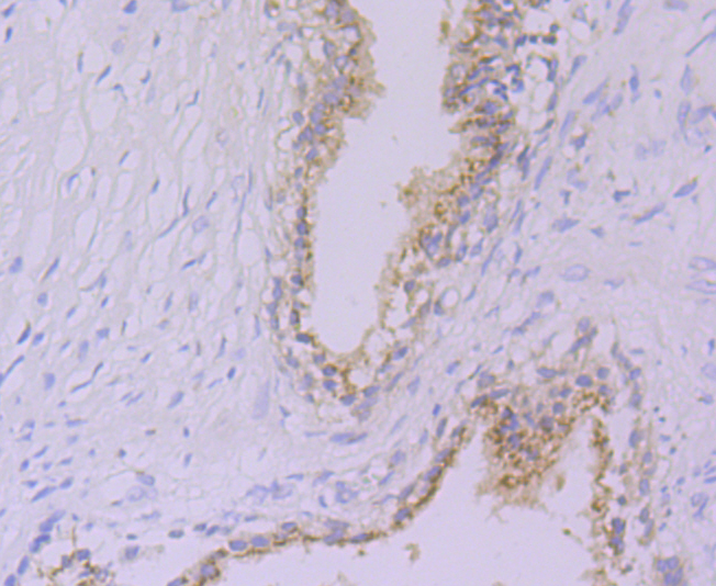 Glucose 6 phosphate isomerase Rabbit mAb