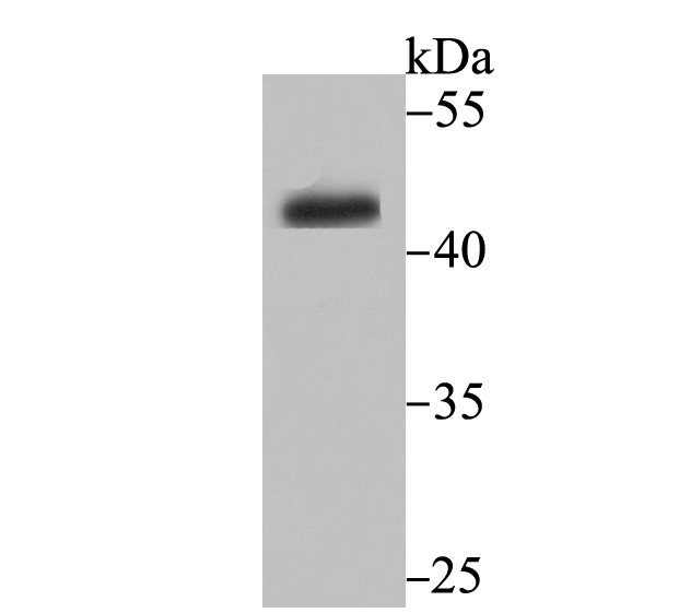 CYP26A1 Rabbit mAb