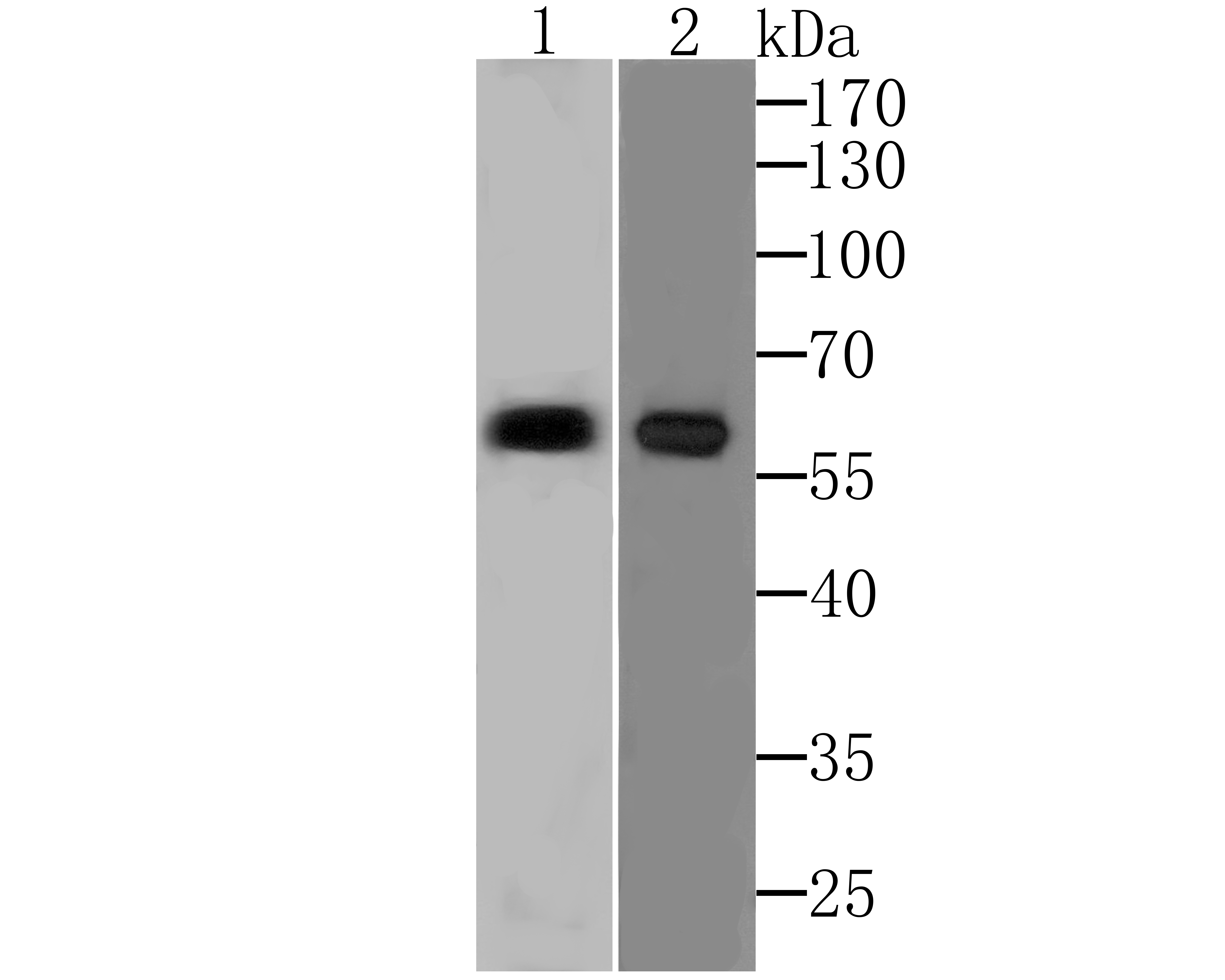 PARP2 Rabbit mAb