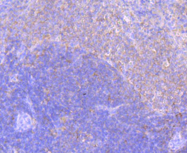 ELMO1 Rabbit mAb