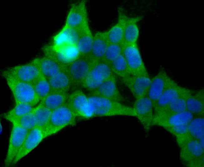 Pumilio 1 Rabbit mAb