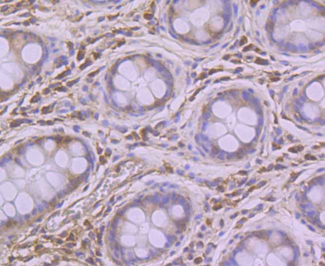 Pumilio 1 Rabbit mAb
