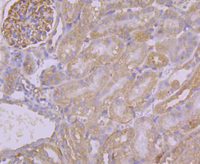 Pumilio 1 Rabbit mAb