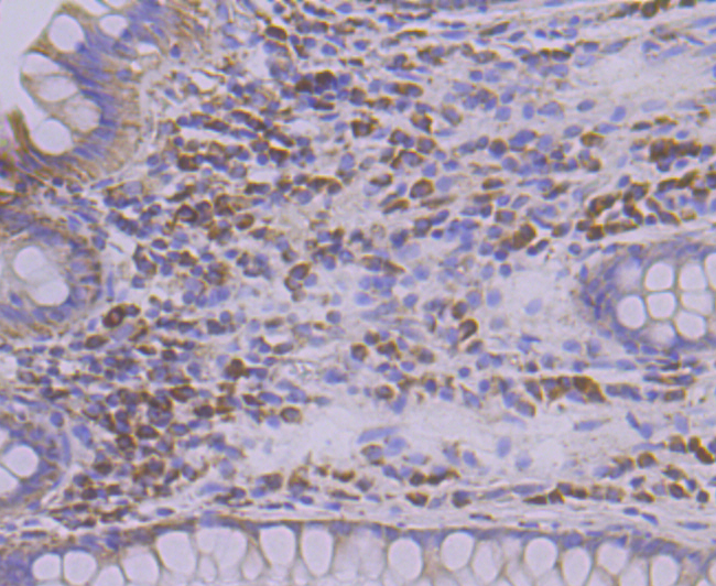 TREX1 Rabbit mAb