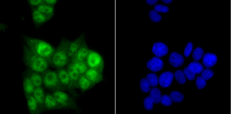 PRPF8 Rabbit mAb