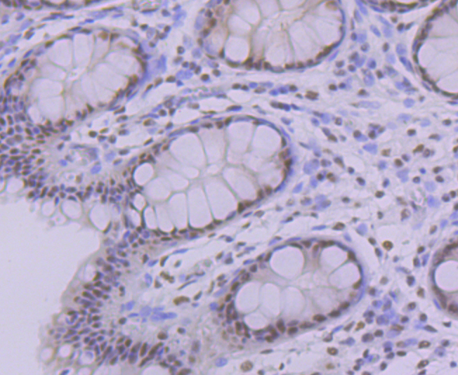 PRPF8 Rabbit mAb