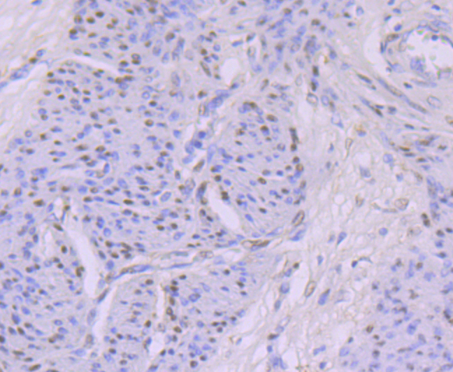 KAT8 Rabbit mAb