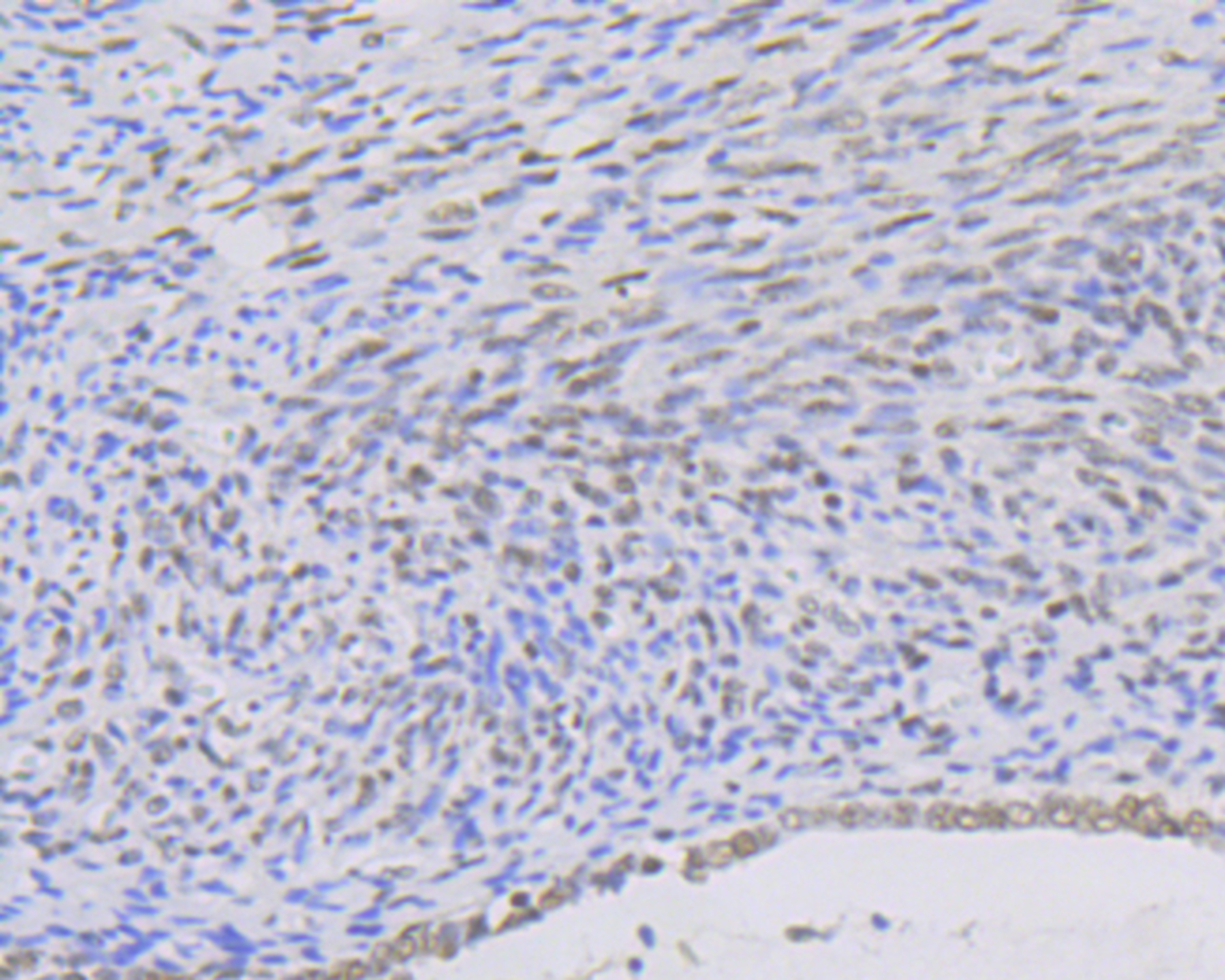 KAT8 Rabbit mAb