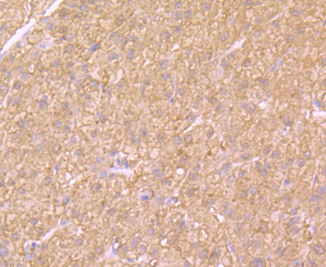 SULT2A1 Rabbit mAb