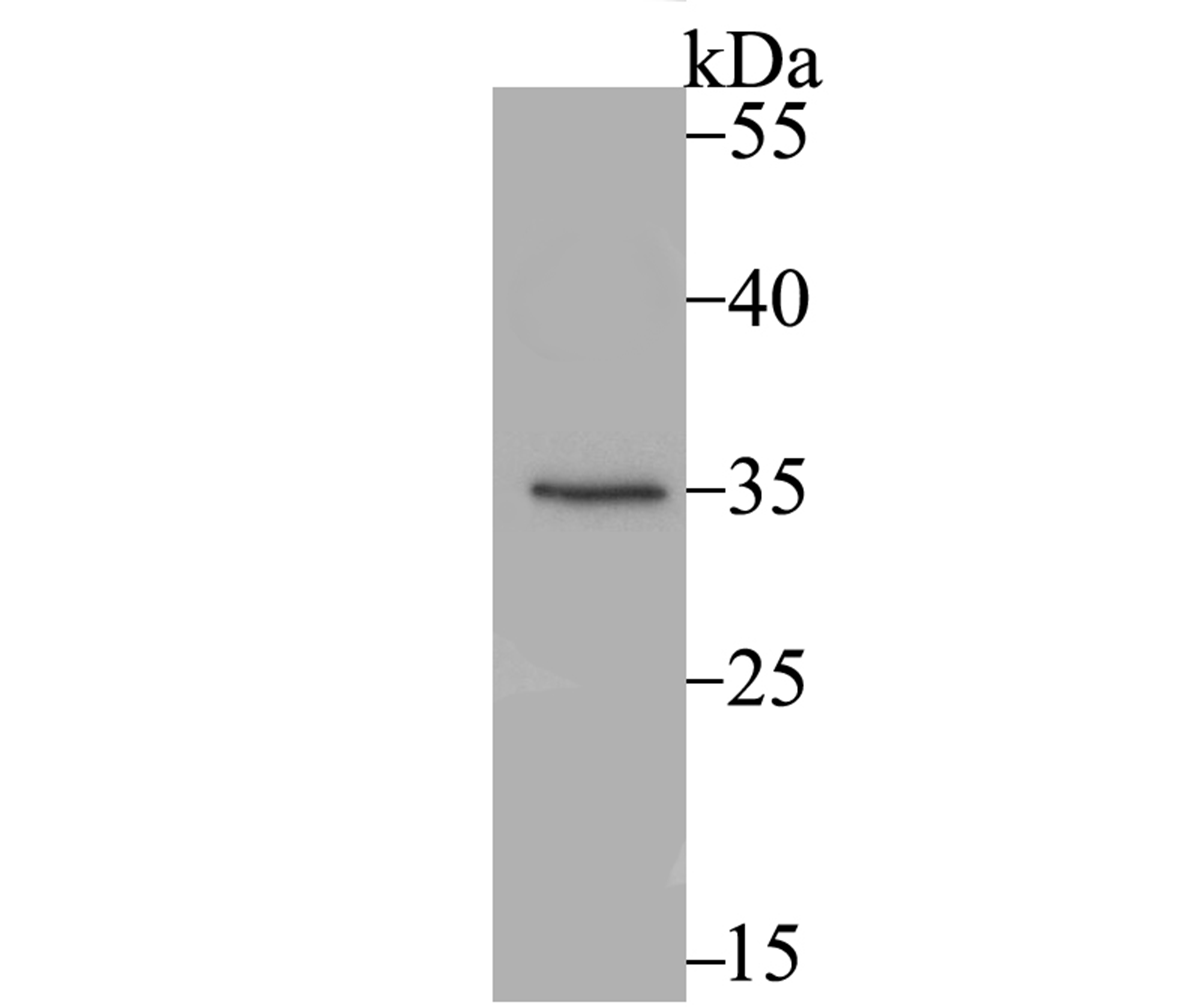 SULT2A1 Rabbit mAb