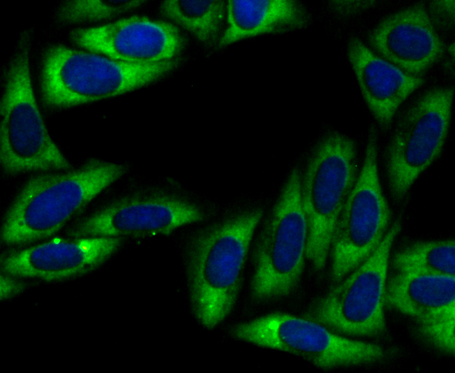 UQCRFS1 Rabbit mAb