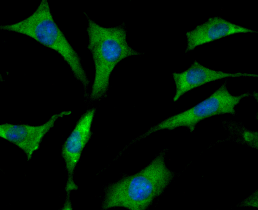 Mib1 Rabbit mAb