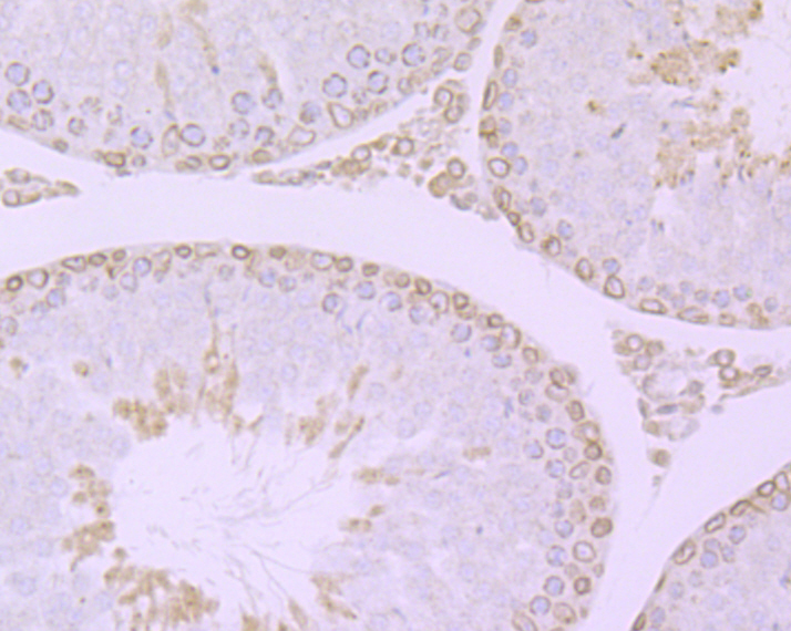 RanGAP1 Rabbit mAb
