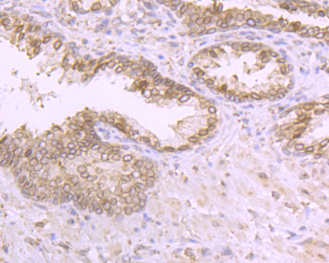 RanGAP1 Rabbit mAb