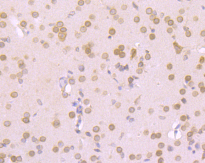 RanGAP1 Rabbit mAb