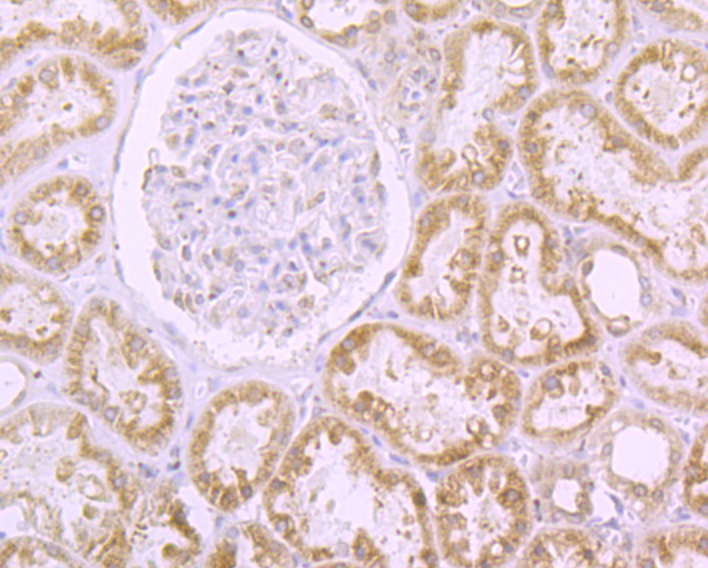 RanGAP1 Rabbit mAb