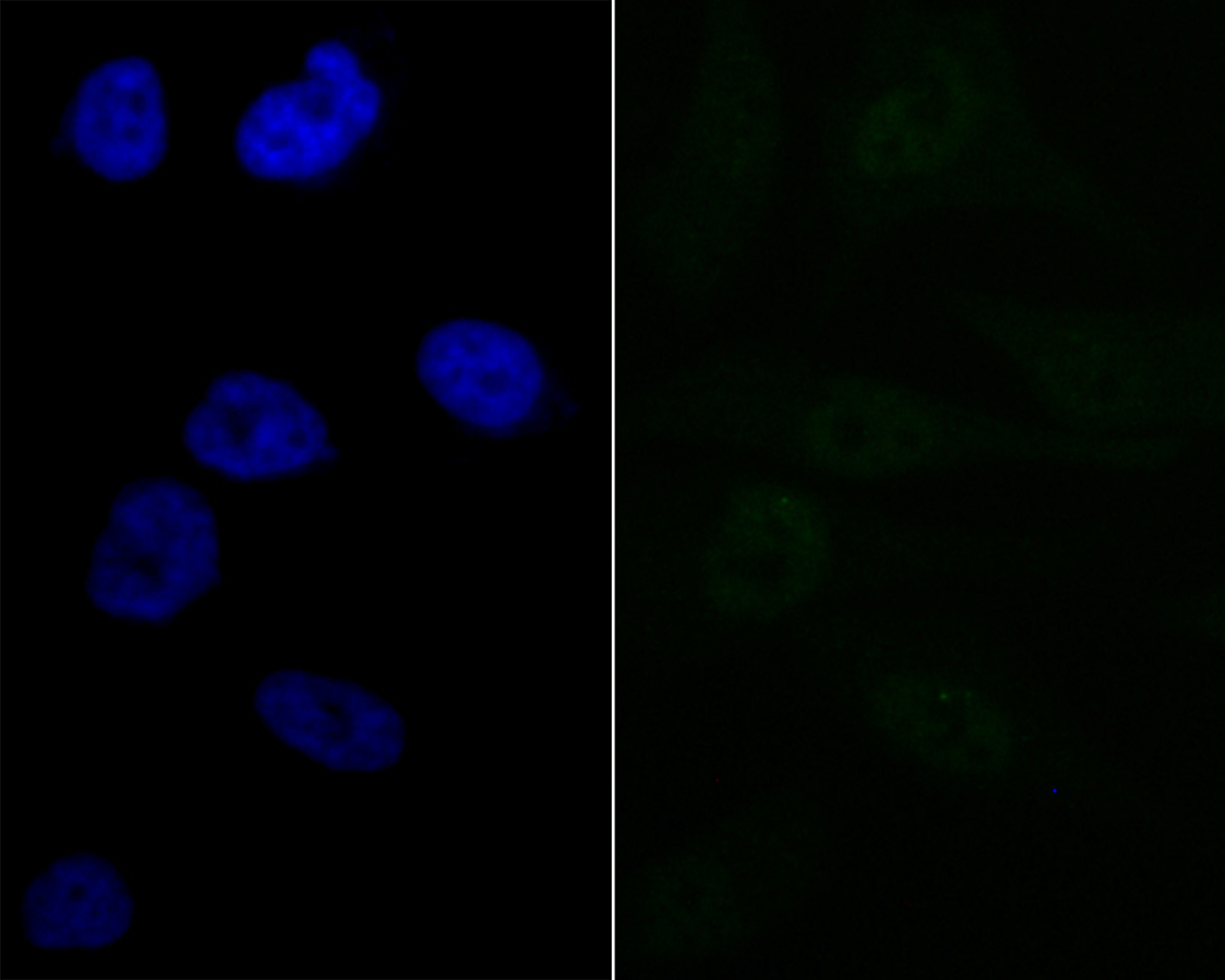 Lipin 1 Rabbit mAb
