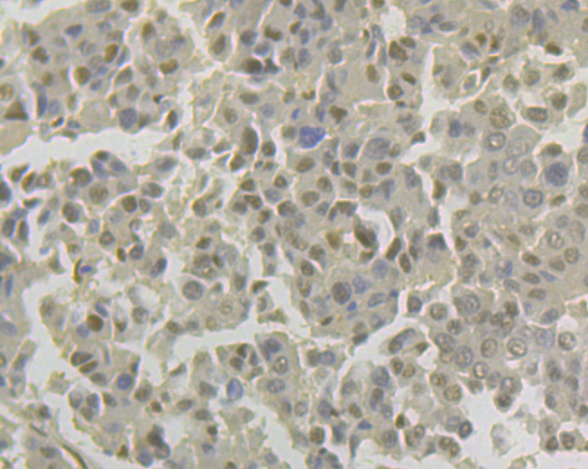 Lipin 1 Rabbit mAb