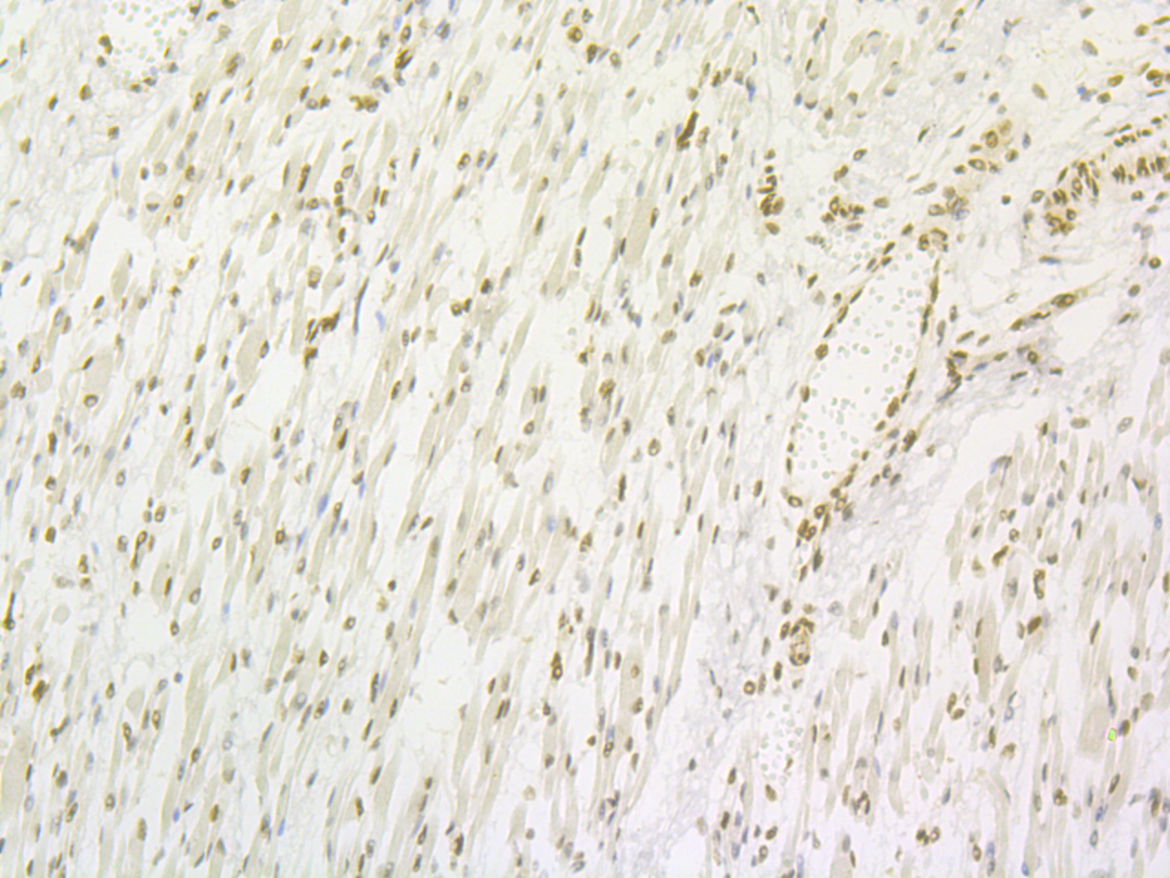 Lipin 1 Rabbit mAb