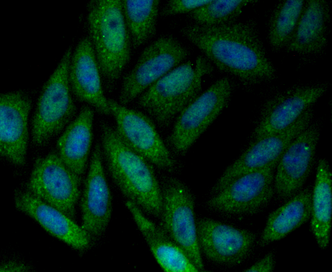 SENP1 Rabbit mAb