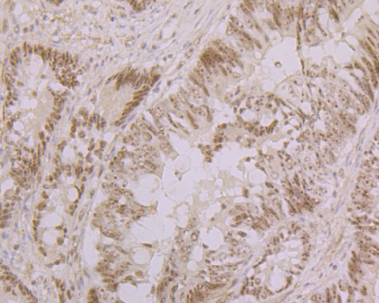 Nucleostemin Rabbit mAb