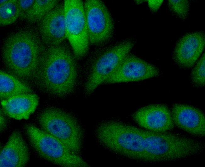 Alcohol Dehydrogenase Rabbit mAb