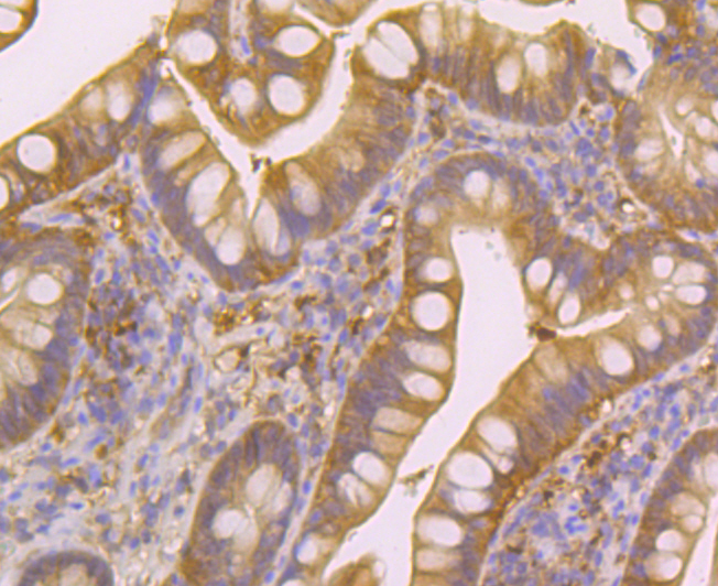 Nudel Rabbit mAb