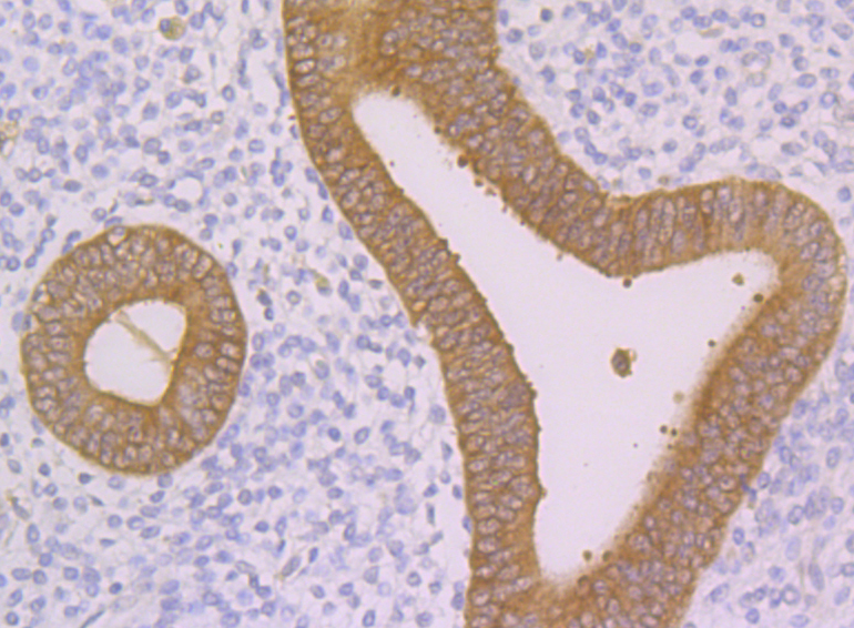 Nudel Rabbit mAb