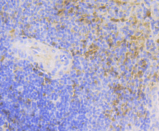 Carbonic Anhydrase I Rabbit mAb