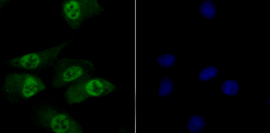 TNPO3 Rabbit mAb