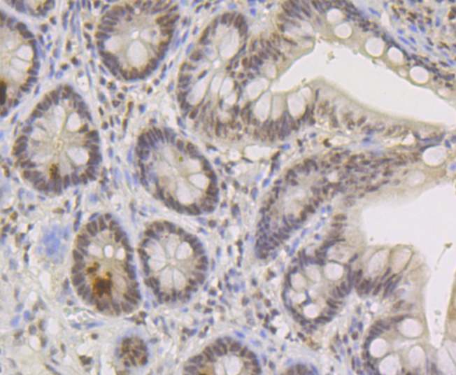 TNPO3 Rabbit mAb