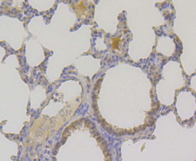 TNPO3 Rabbit mAb