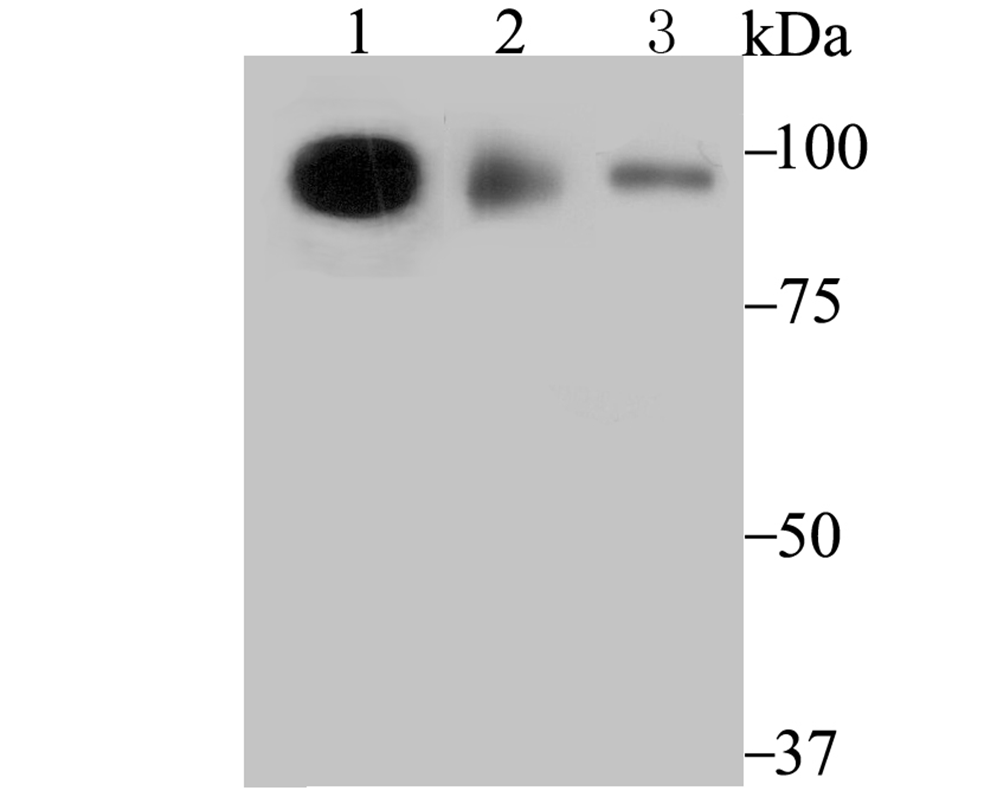 TNPO3 Rabbit mAb