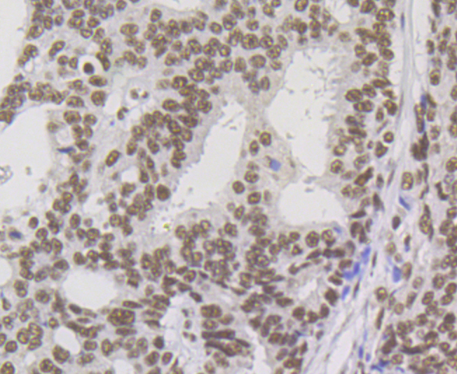 p54nrb Rabbit mAb