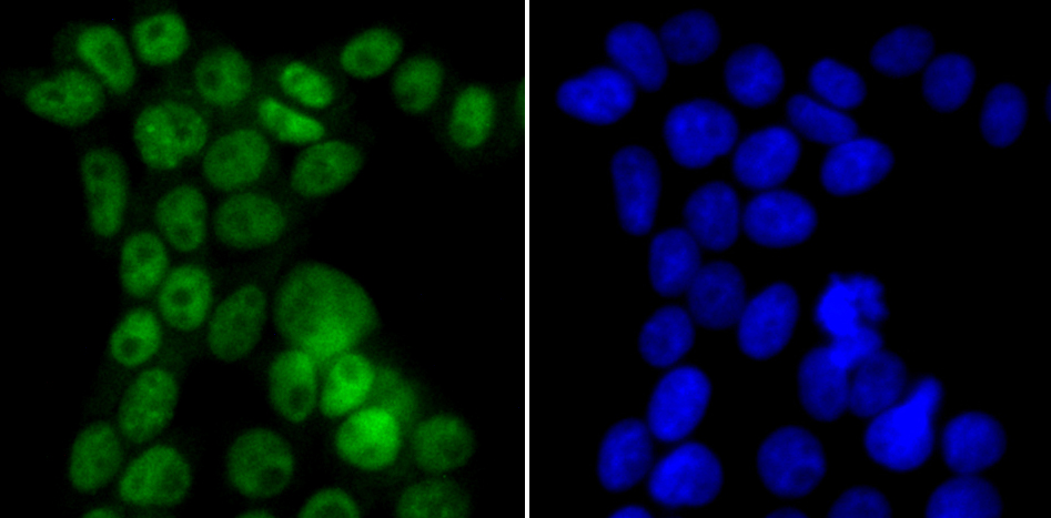 p150 CAF1 Rabbit mAb