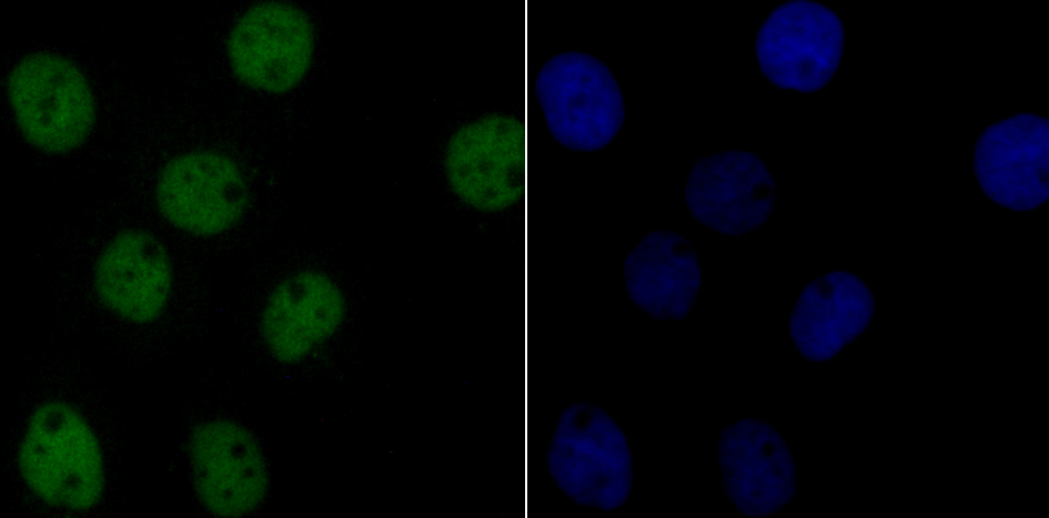 p60 CAF1 Rabbit mAb