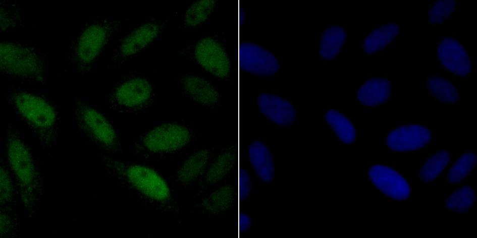 p60 CAF1 Rabbit mAb