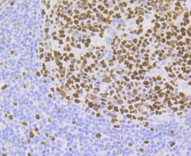p60 CAF1 Rabbit mAb
