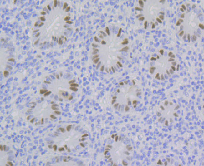 p60 CAF1 Rabbit mAb
