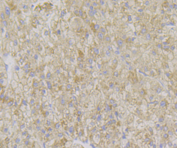 ADAMTS13 Rabbit mAb