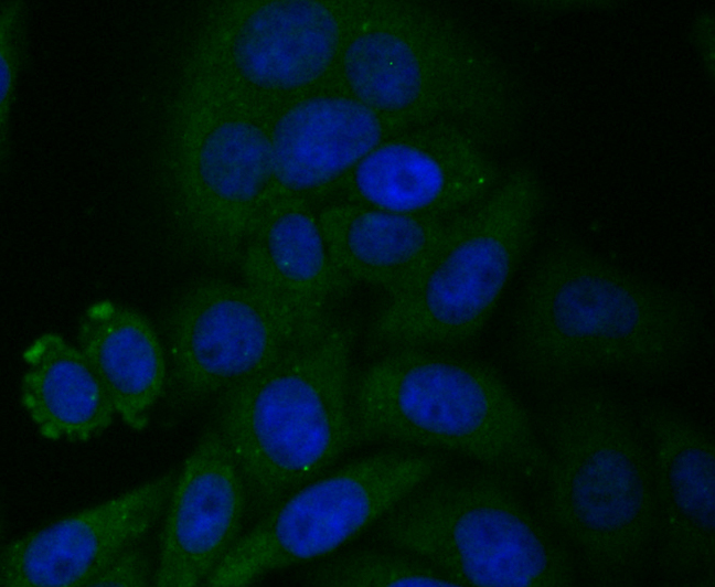 CYP27A1 Rabbit mAb