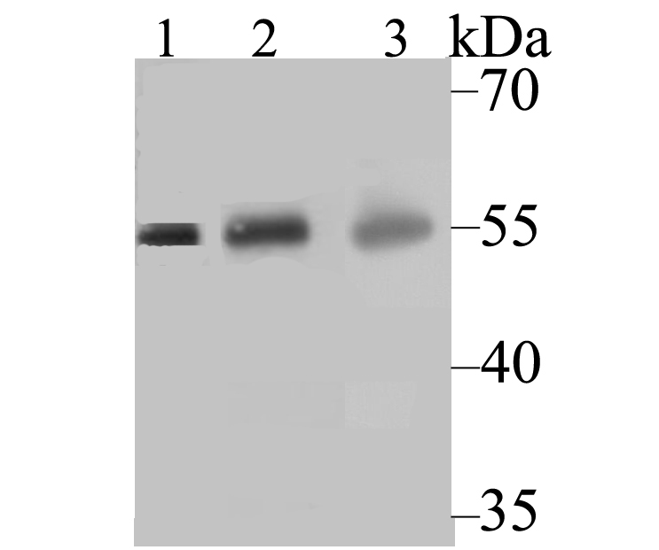 CYP27A1 Rabbit mAb
