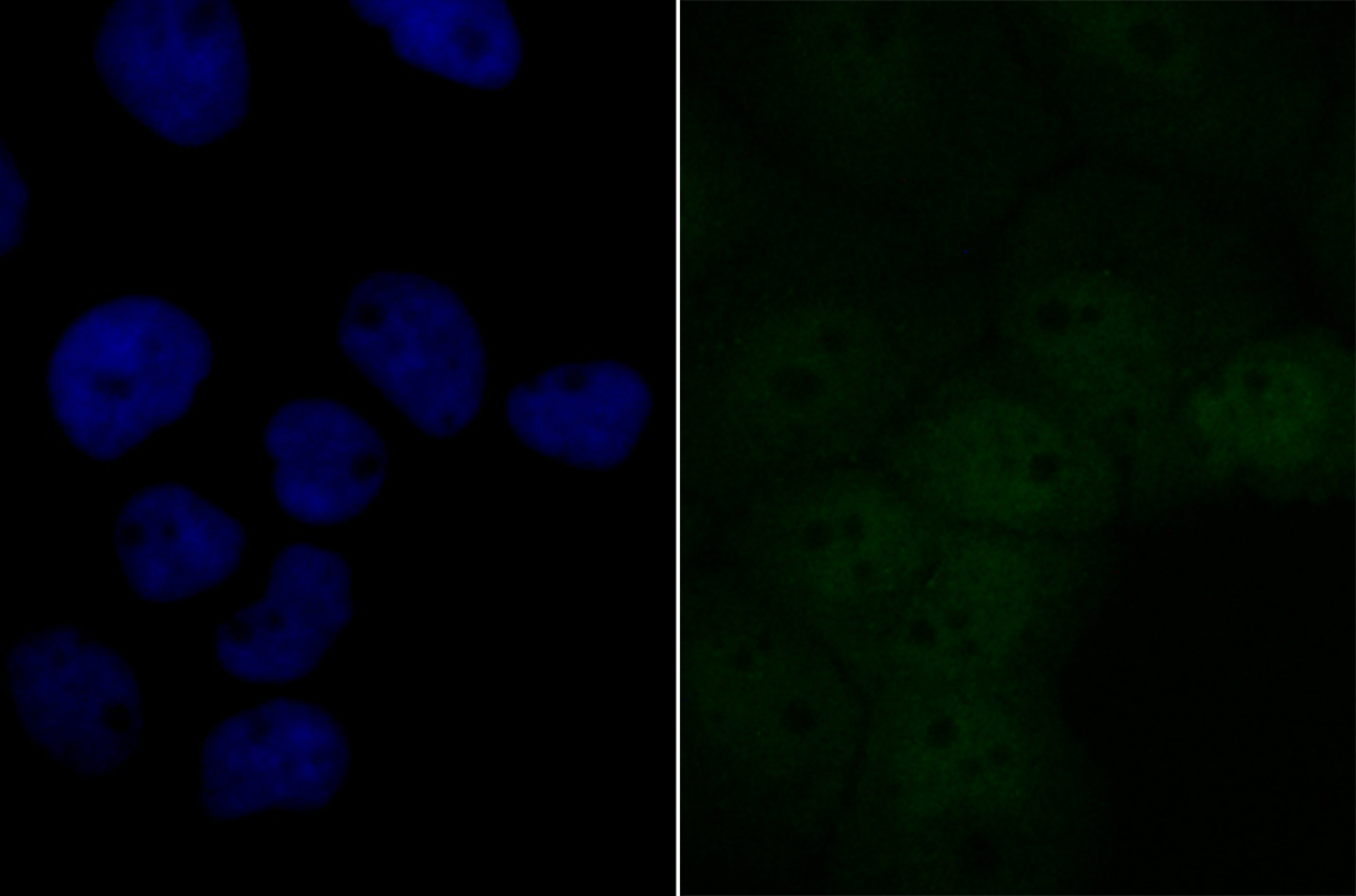BRD2 Rabbit mAb